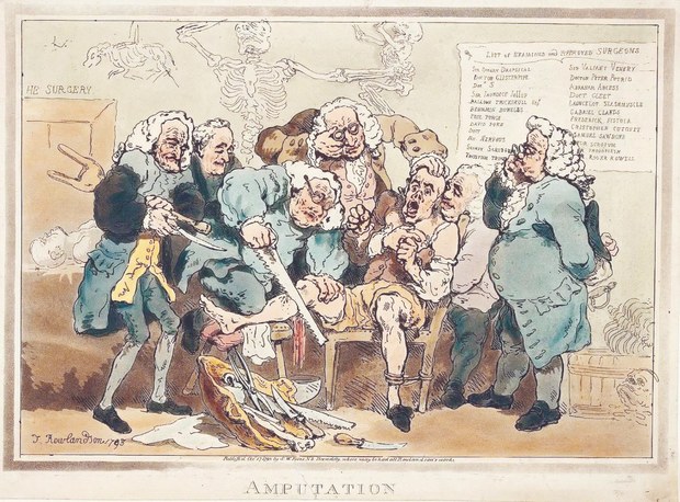 Five_surgeons_participating_in_the_amputation_Wellcome_L0034242.jpg